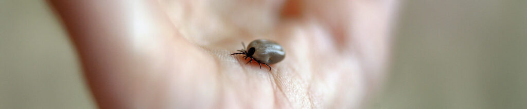 Sie sehen eine Zecke auf einer Handfläche sitzen. Borreliose, auch Lyme-Borreliose genannt, ist hinsichtlich ihrer Diagnostizierbarkeit eine relativ neue Krankheit: Sie wurde in den 1970er Jahren im Ort Lyme im US-Bundesstaat Connecticut erstmals beobachtet. Ihr Erreger, Borrelia burgdorferi, erhielt seinen Namen vom Schweizer Bakteriologen Willy Burgdorfer, der das Bakterium 1981 in den USA entdeckte und beschrieb. Die Krankheit wird durch Zecken (Ixodes ricinus) übertragen.