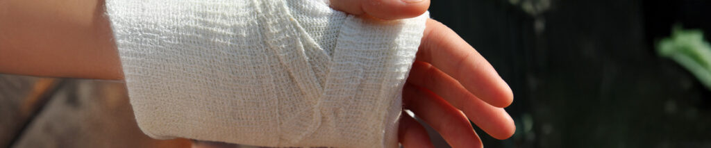 Sie sehen eine Hand in Gips. Die Hand ist gebrochen.